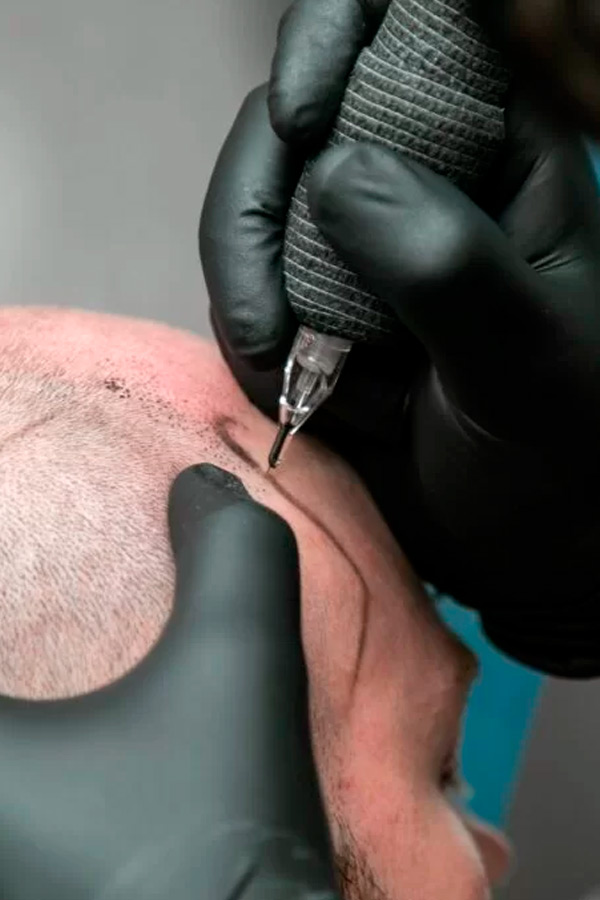 micropigmentacion-capilar-valencia-smp