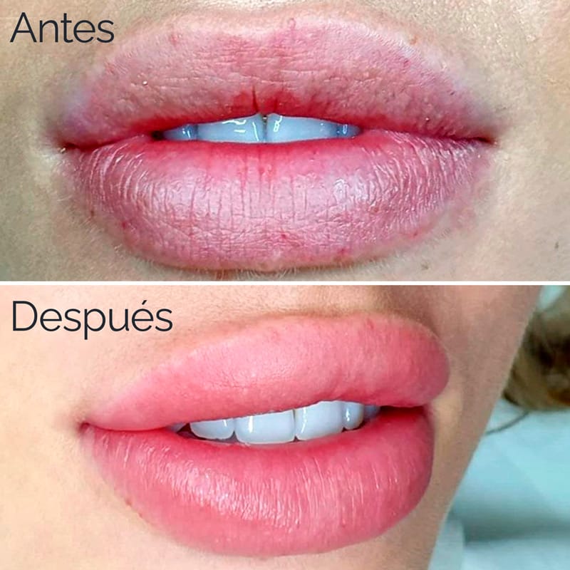 micropigmentacion-labios-valencia